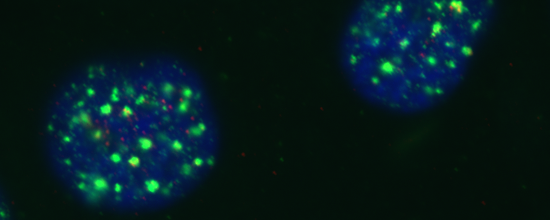 HPV Activates the ATM DNA Damage Response